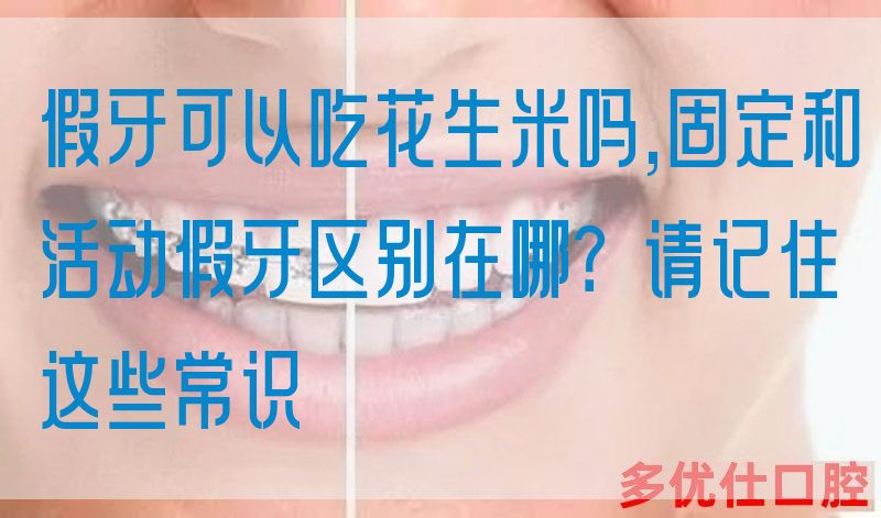 假牙可以吃花生米吗,固定和活动假牙区别在哪？请记住这些常识(图1)