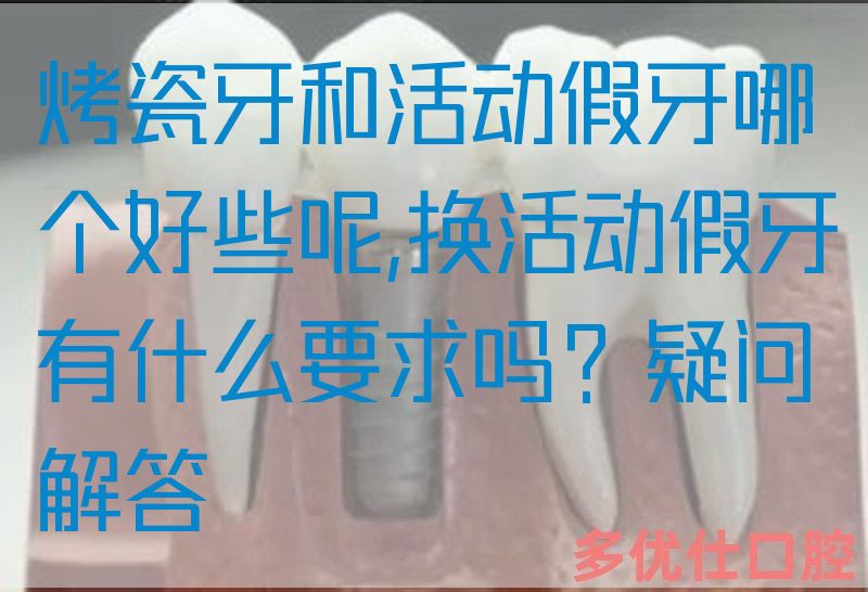 烤瓷牙和活动假牙哪个好些呢,换活动假牙有什么要求吗？疑问解答(图1)