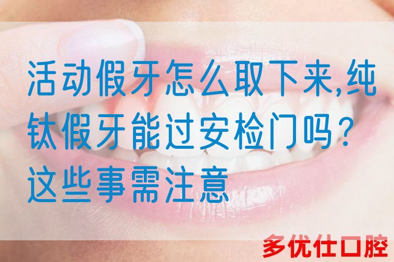 活动假牙怎么取下来,纯钛假牙能过安检门吗？这些事需注意(图1)