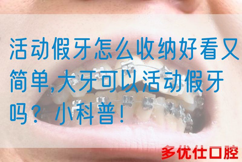 活动假牙怎么收纳好看又简单,大牙可以活动假牙吗？小科普！(图1)