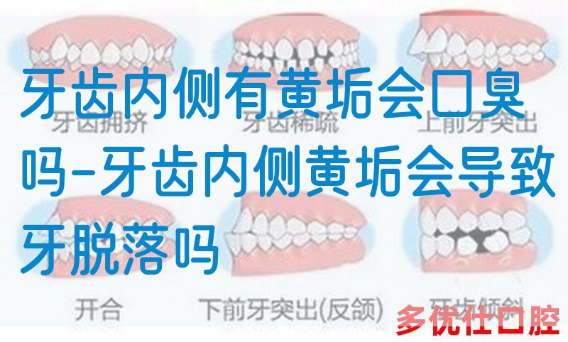 牙齿内侧有黄垢会口臭吗-牙齿内侧黄垢会导致牙脱落吗