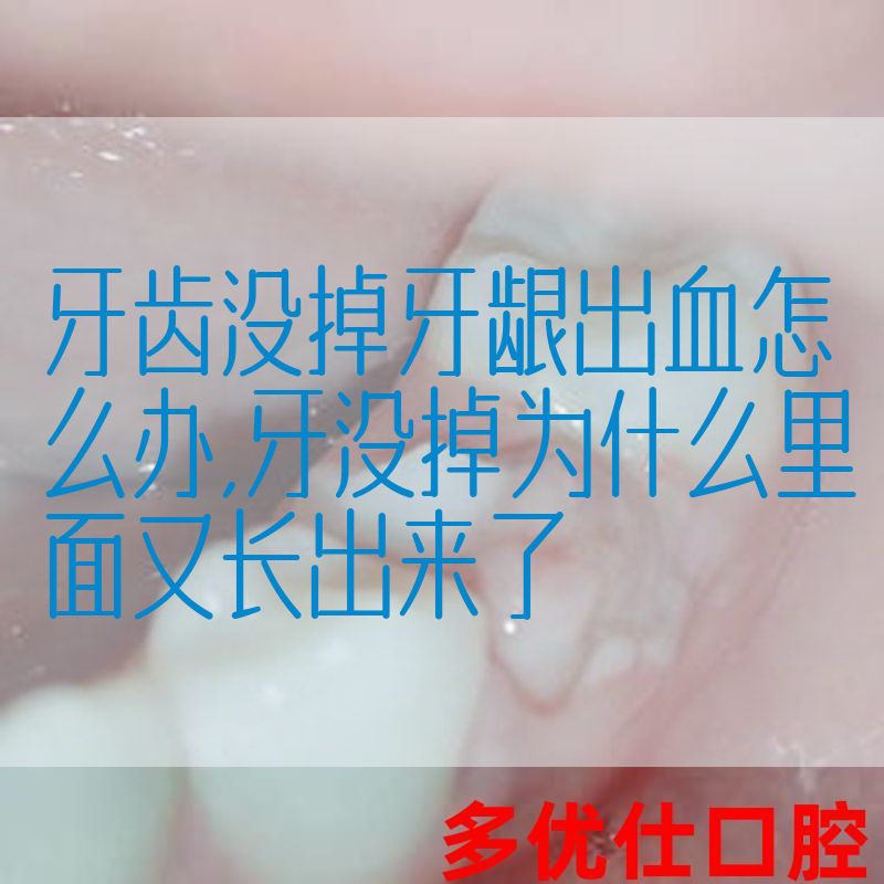 牙齿没掉牙龈出血怎么办,牙没掉为什么里面又长出来了