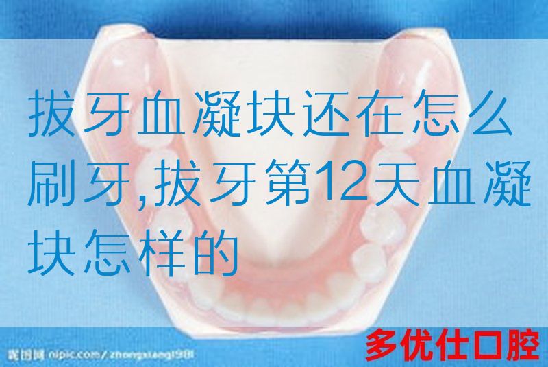拔牙血凝块还在怎么刷牙,拔牙第12天血凝块怎样的