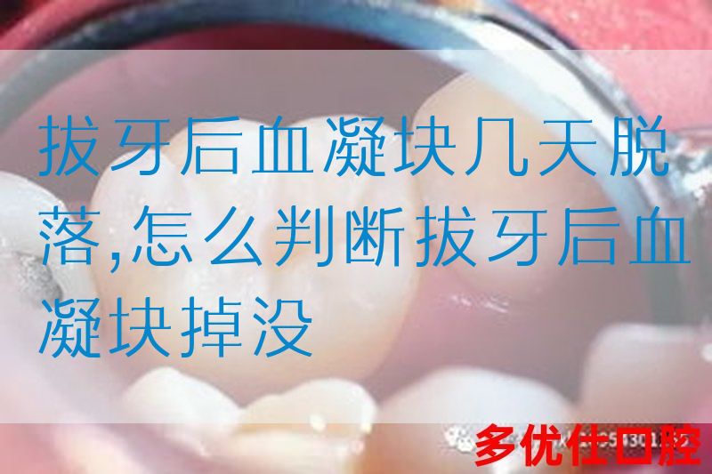 拔牙后血凝块几天脱落,怎么判断拔牙后血凝块掉没