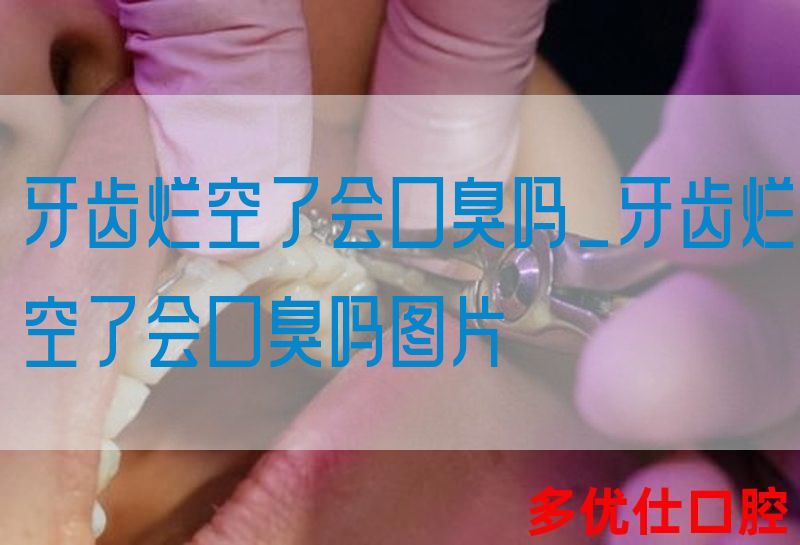 牙齿烂空了会口臭吗_牙齿烂空了会口臭吗图片
