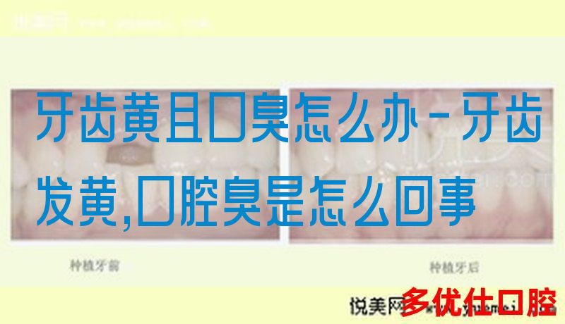 牙齿黄且口臭怎么办-牙齿发黄,口腔臭是怎么回事