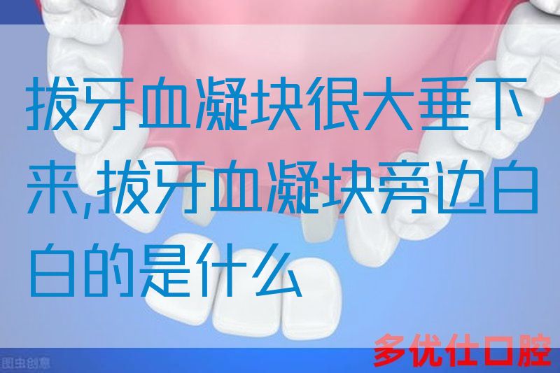 拔牙血凝块很大垂下来,拔牙血凝块旁边白白的是什么