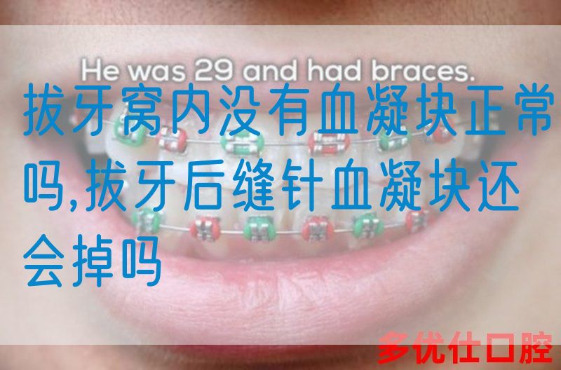 拔牙窝内没有血凝块正常吗,拔牙后缝针血凝块还会掉吗