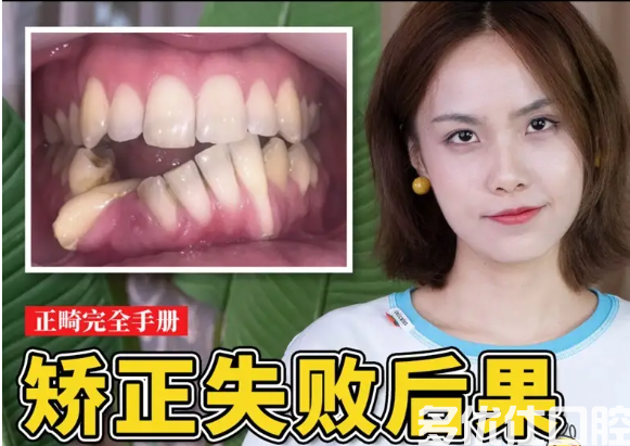 正畸失败的最坏结果是什么?还能恢复吗?修复后需要注意什么?