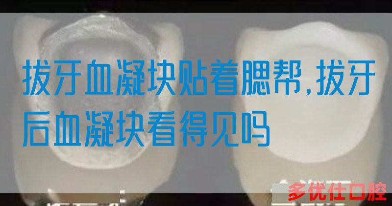 拔牙血凝块贴着腮帮,拔牙后血凝块看得见吗