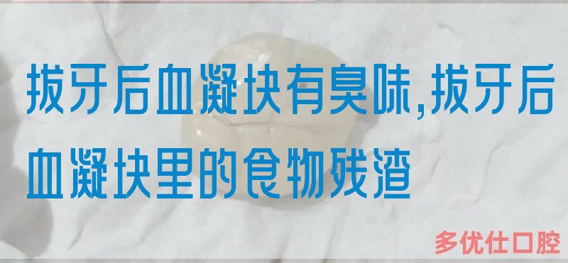 拔牙后血凝块有臭味,拔牙后血凝块里的食物残渣