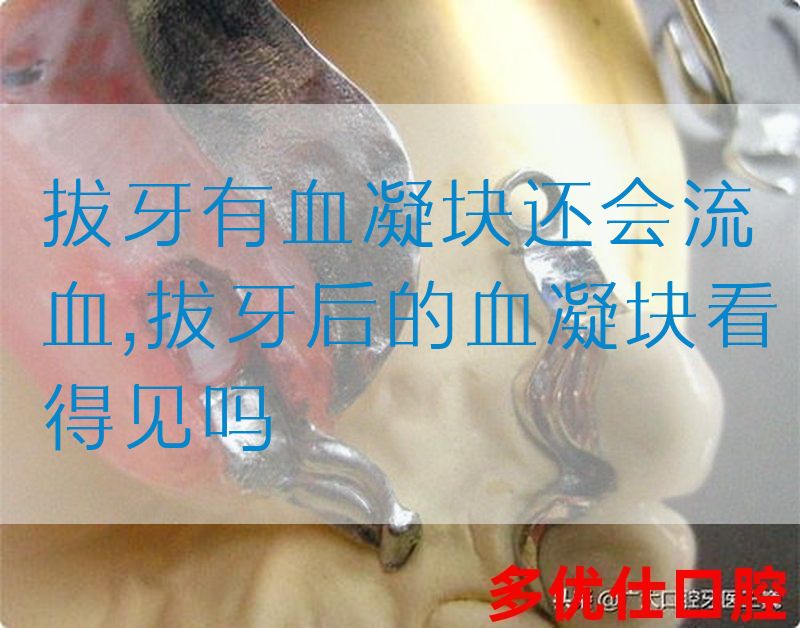 拔牙有血凝块还会流血,拔牙后的血凝块看得见吗