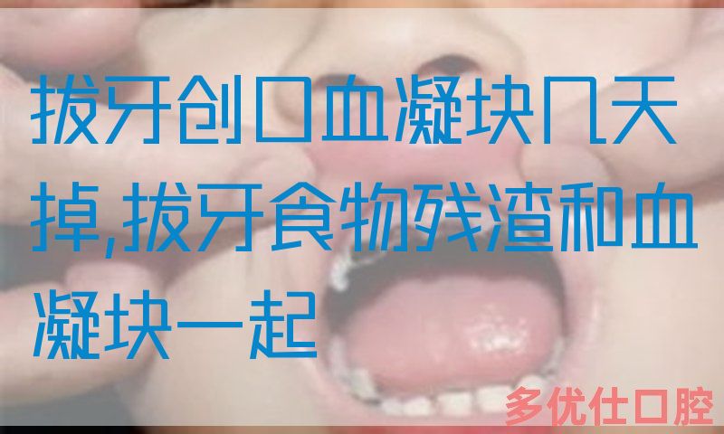 拔牙创口血凝块几天掉,拔牙食物残渣和血凝块一起(图1)