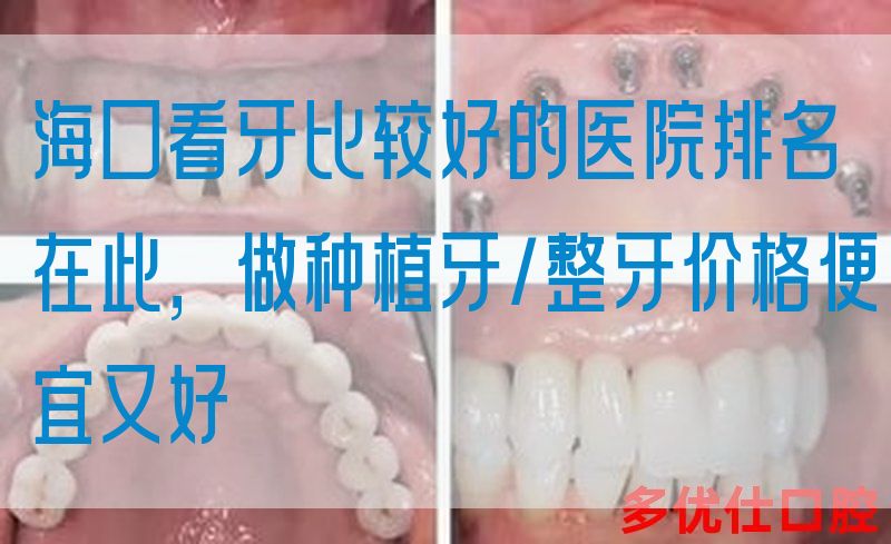 海口看牙比较好的医院排名在此，做种植牙/整牙价格便宜又好