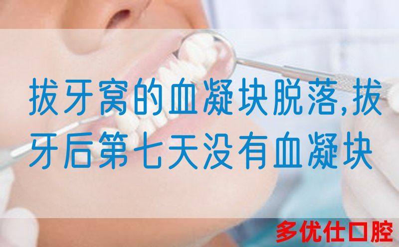 拔牙窝的血凝块脱落,拔牙后第七天没有血凝块
