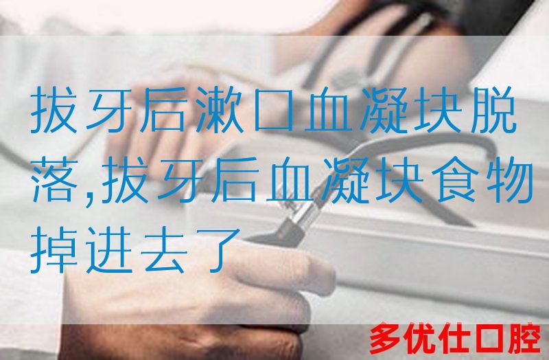 拔牙后漱口血凝块脱落,拔牙后血凝块食物掉进去了(图1)