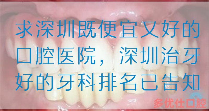 求深圳既便宜又好的口腔医院，深圳治牙好的牙科排名已告知