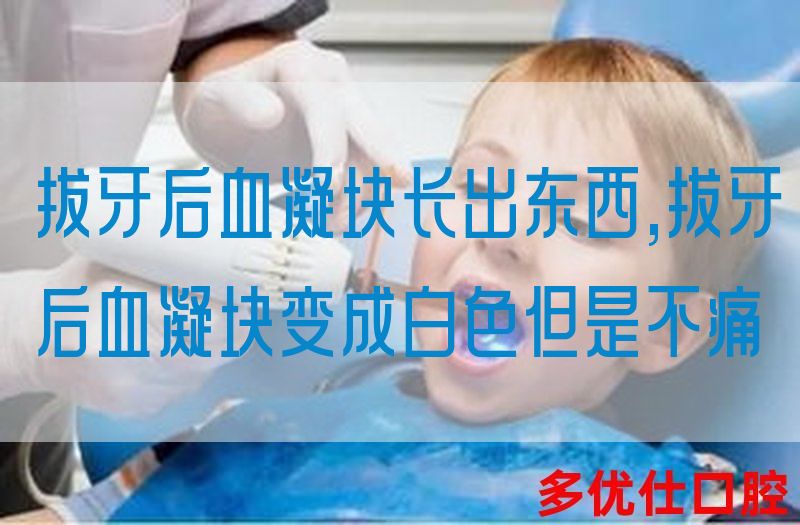 拔牙后血凝块长出东西,拔牙后血凝块变成白色但是不痛(图1)