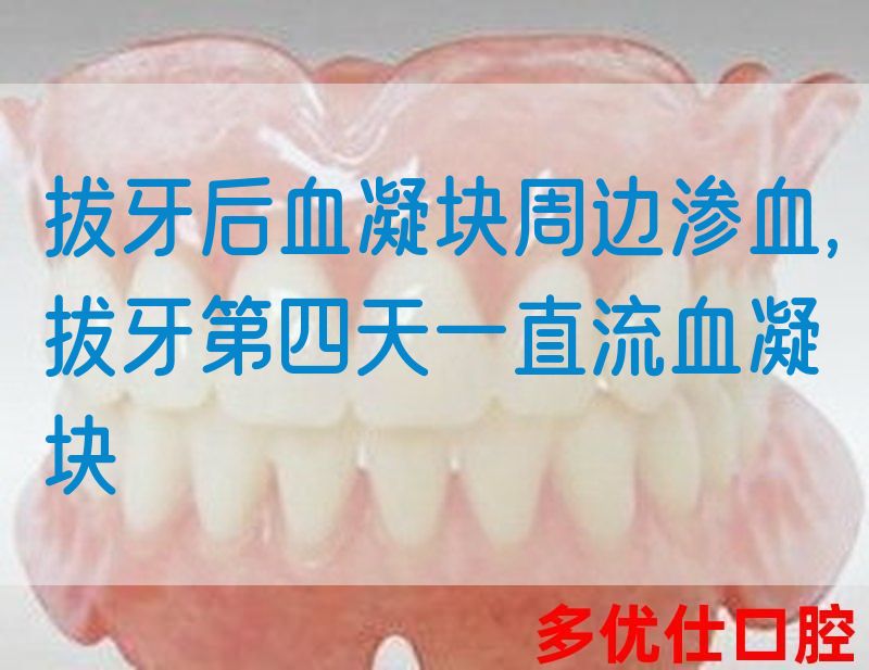 拔牙后血凝块周边渗血,拔牙第四天一直流血凝块(图1)