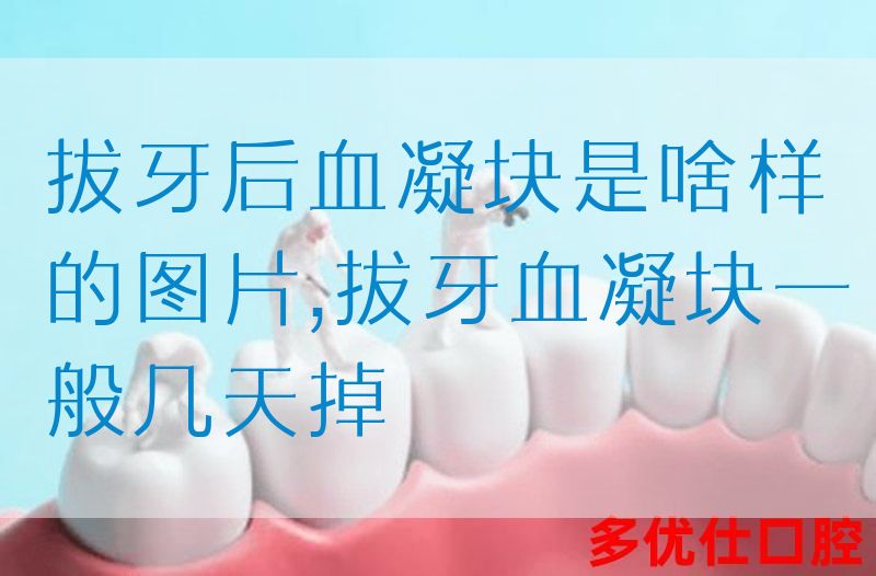 拔牙后血凝块是啥样的图片,拔牙血凝块一般几天掉(图1)