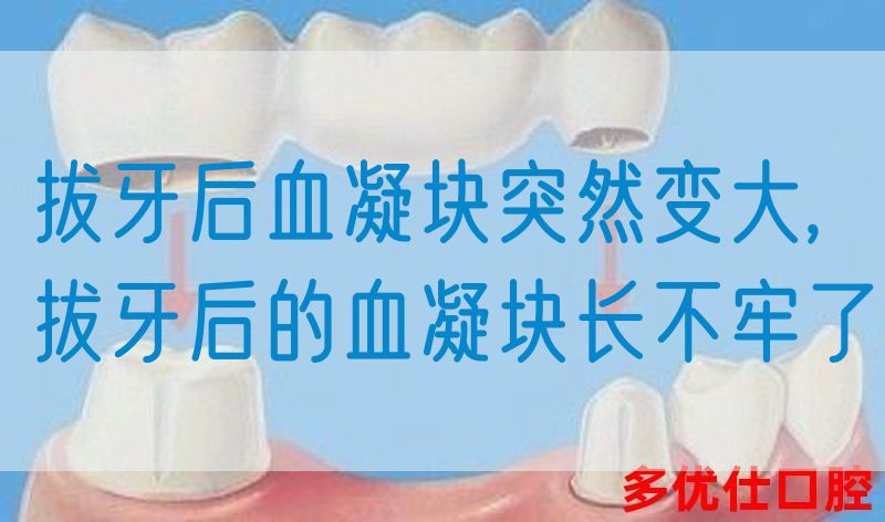 拔牙后血凝块突然变大,拔牙后的血凝块长不牢了(图1)