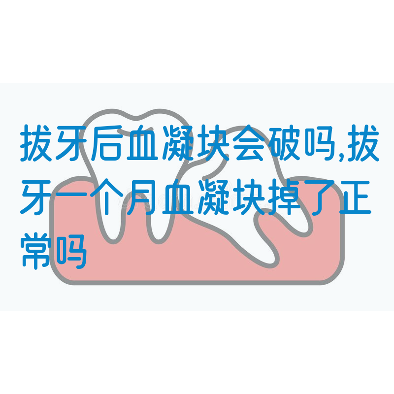拔牙后血凝块会破吗,拔牙一个月血凝块掉了正常吗(图1)