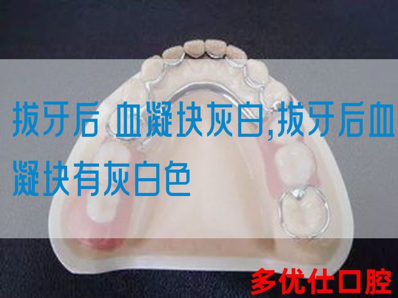 拔牙后 血凝块灰白,拔牙后血凝块有灰白色(图1)