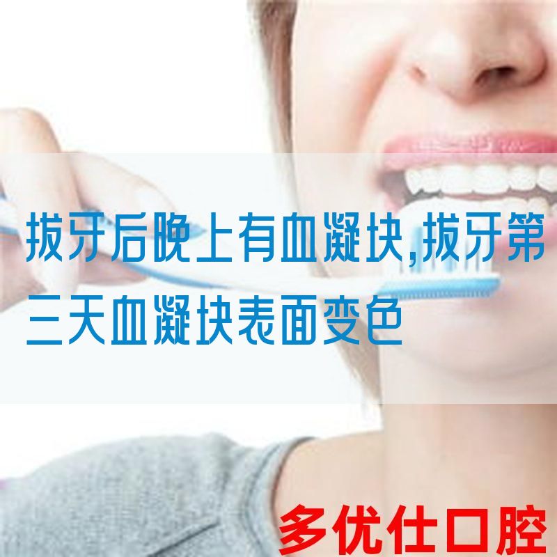 拔牙后晚上有血凝块,拔牙第三天血凝块表面变色
