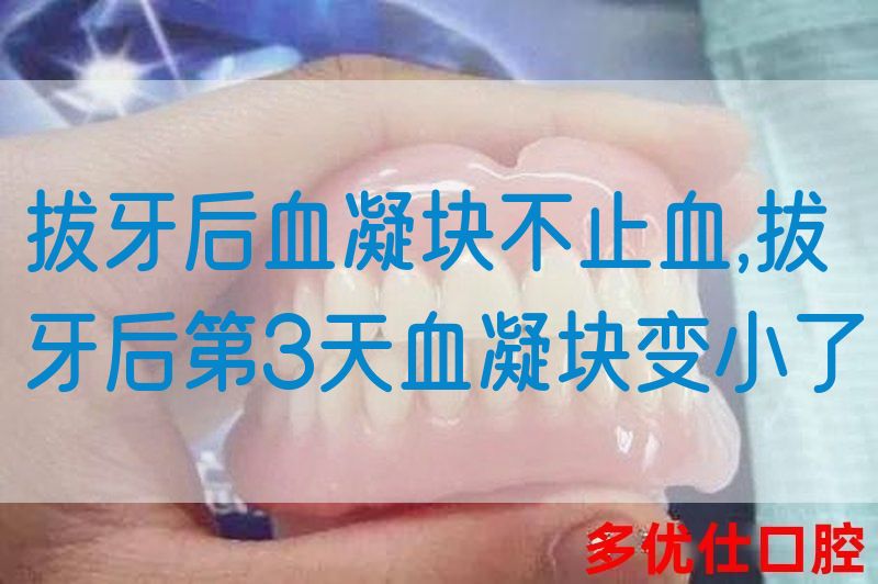 拔牙后血凝块不止血,拔牙后第3天血凝块变小了(图1)