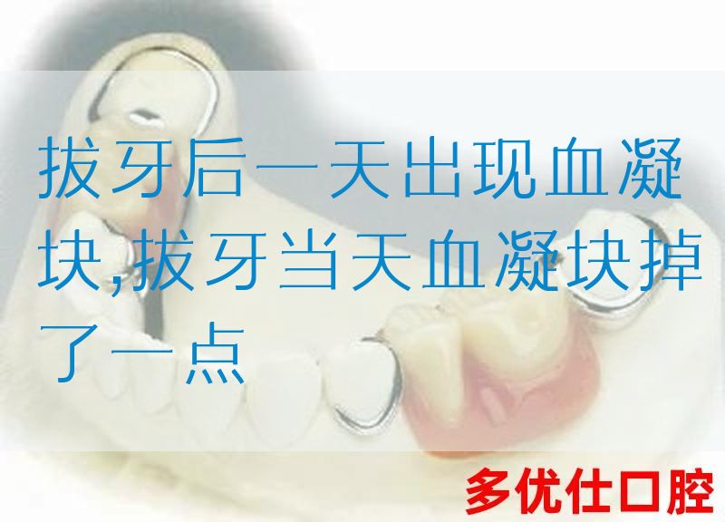 拔牙后一天出现血凝块,拔牙当天血凝块掉了一点