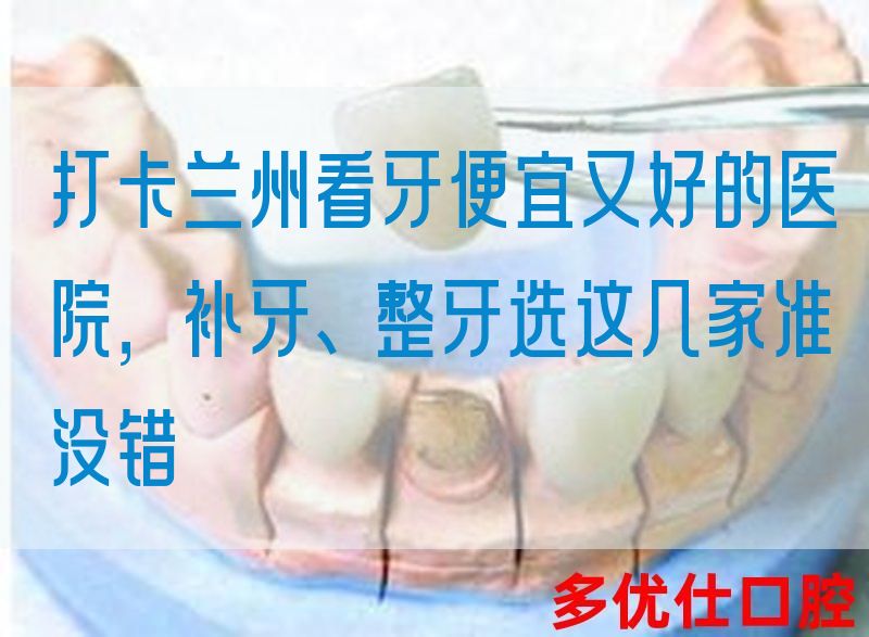 打卡兰州看牙便宜又好的医院，补牙、整牙选这几家准没错