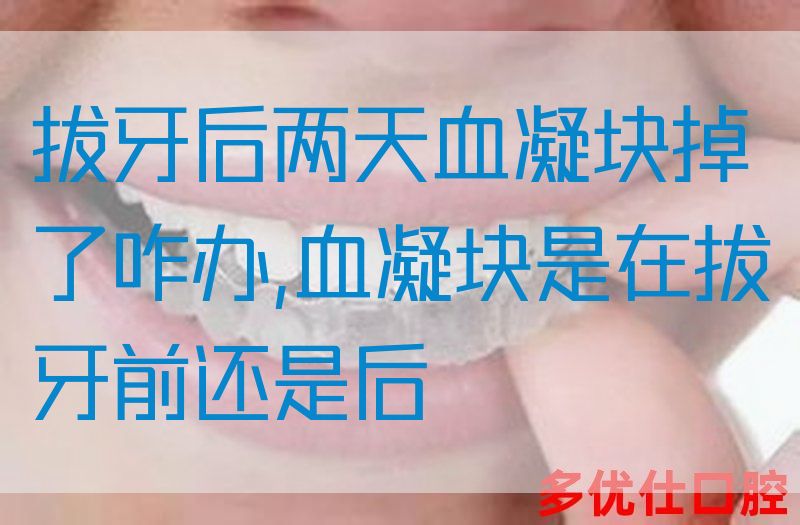 拔牙后两天血凝块掉了咋办,血凝块是在拔牙前还是后(图1)