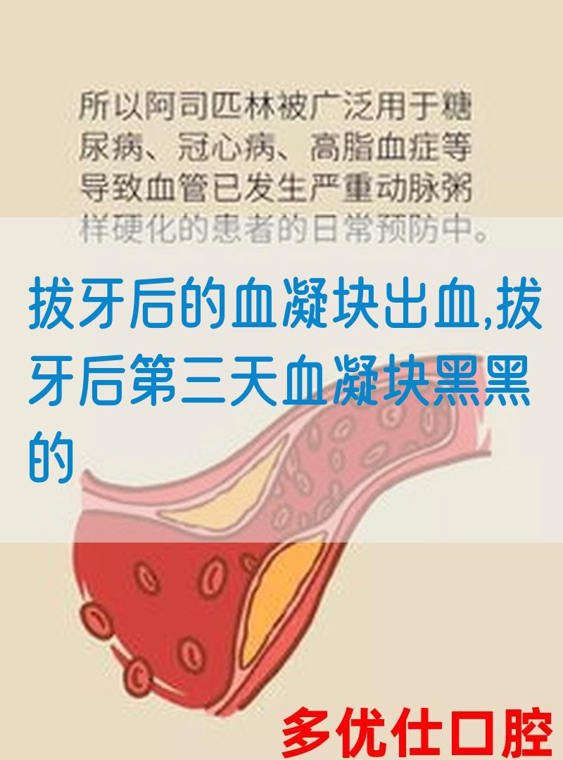拔牙后的血凝块出血,拔牙后第三天血凝块黑黑的(图1)