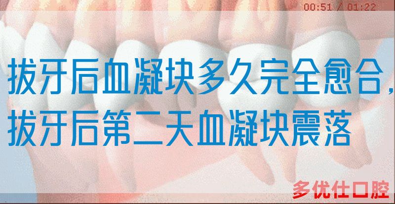 拔牙后血凝块多久完全愈合,拔牙后第二天血凝块震落