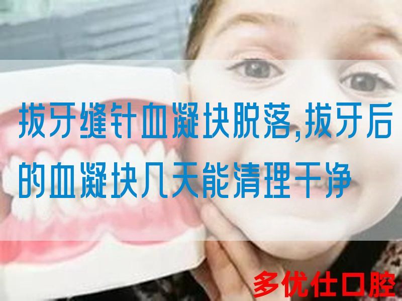 拔牙缝针血凝块脱落,拔牙后的血凝块几天能清理干净(图1)