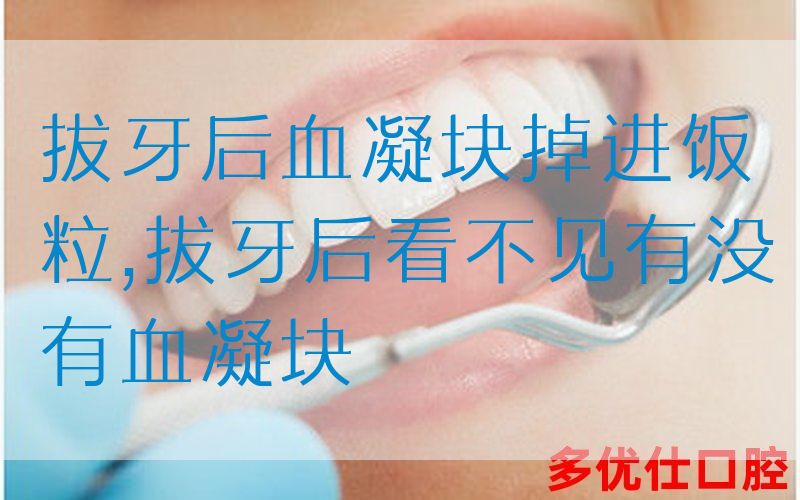 拔牙后血凝块掉进饭粒,拔牙后看不见有没有血凝块