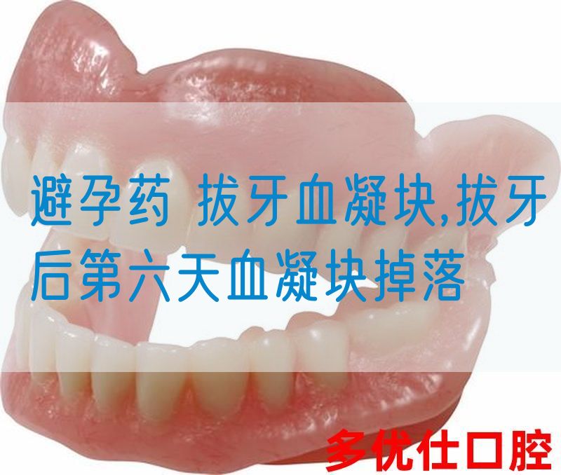 *药 拔牙血凝块,拔牙后第六天血凝块掉落