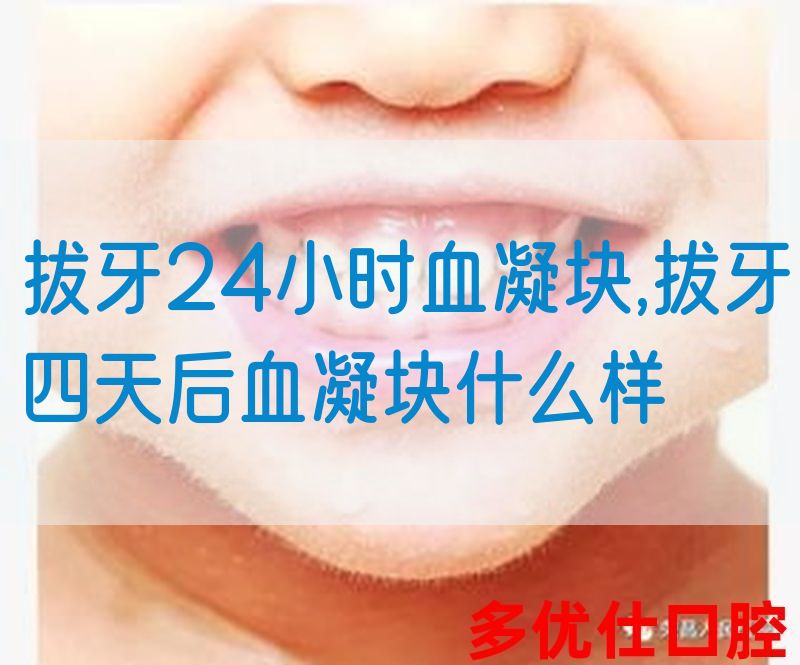 拔牙24小时血凝块,拔牙四天后血凝块什么样(图1)