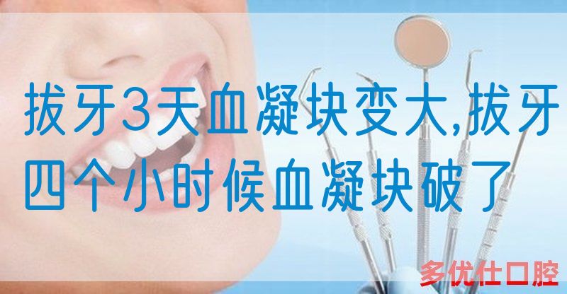 拔牙3天血凝块变大,拔牙四个小时候血凝块破了(图1)