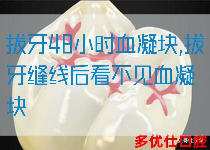 拔牙48小时血凝块,拔牙缝线后看不见血凝块(图1)