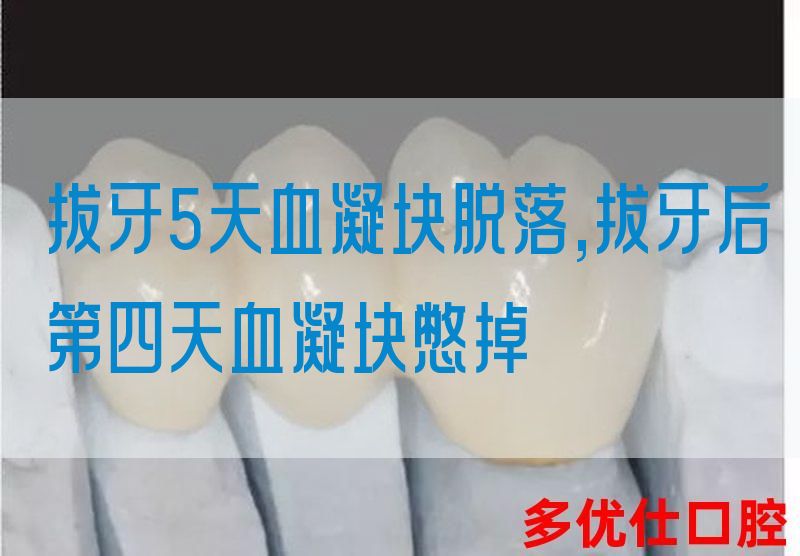 拔牙5天血凝块脱落,拔牙后第四天血凝块憋掉(图1)