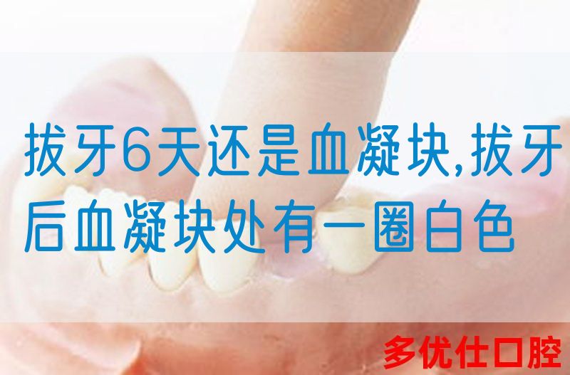 拔牙6天还是血凝块,拔牙后血凝块处有一圈白色(图1)