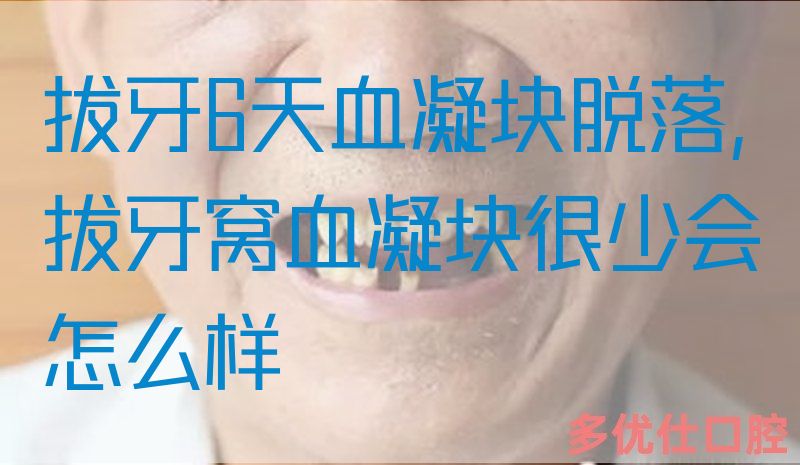 拔牙6天血凝块脱落,拔牙窝血凝块很少会怎么样(图1)