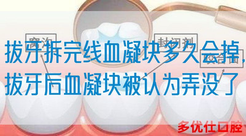 拔牙拆完线血凝块多久会掉,拔牙后血凝块被认为弄没了(图1)