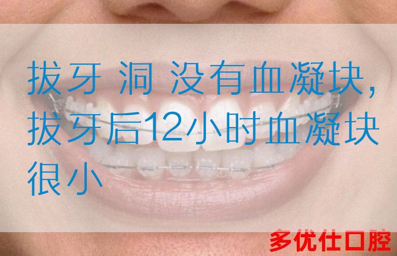 拔牙 洞 没有血凝块,拔牙后12小时血凝块很小(图1)