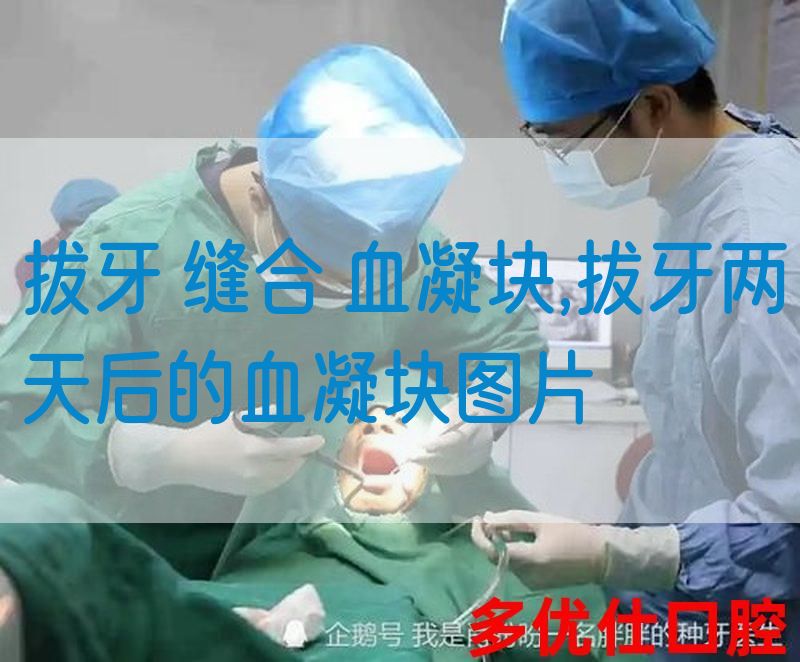拔牙 缝合 血凝块,拔牙两天后的血凝块图片(图1)
