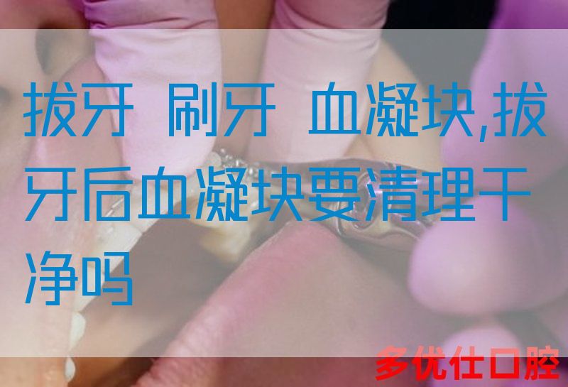 拔牙 刷牙 血凝块,拔牙后血凝块要清理干净吗(图1)