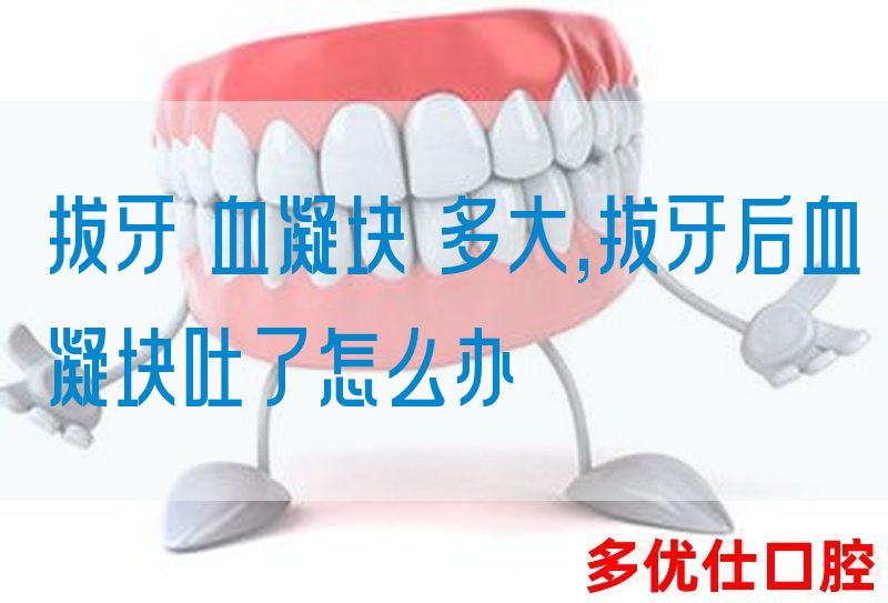 拔牙 血凝块 多大,拔牙后血凝块吐了怎么办(图1)