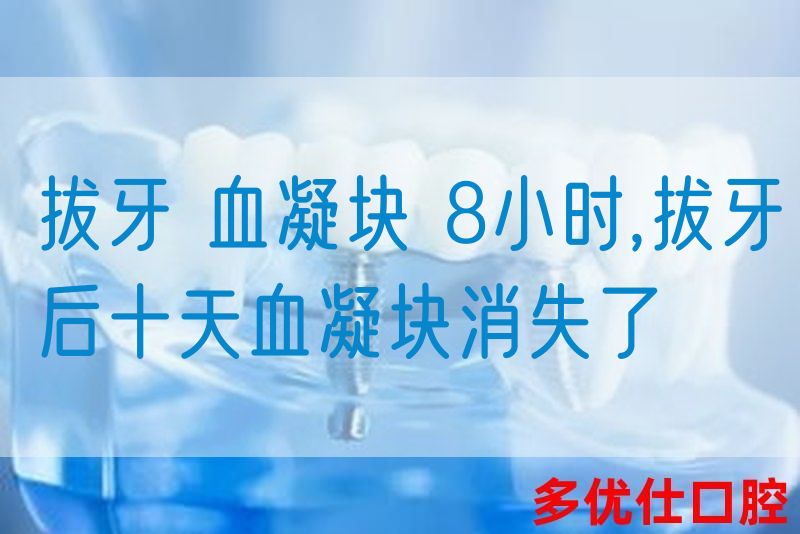 拔牙 血凝块 8小时,拔牙后十天血凝块消失了(图1)