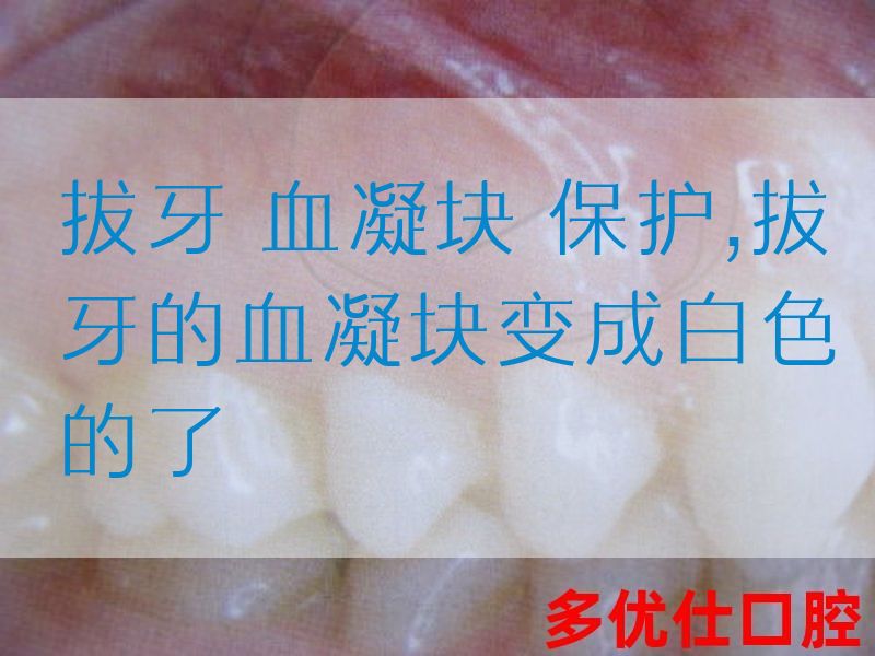 拔牙 血凝块 保护,拔牙的血凝块变成白色的了(图1)